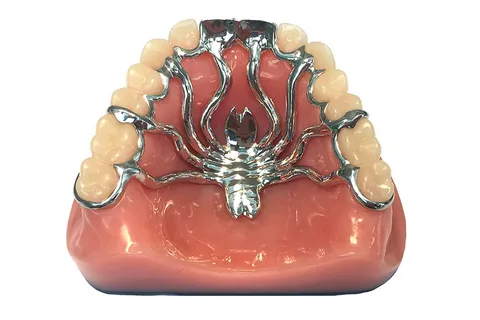 Протезирование зубов бюгельными протезами